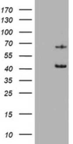 KRT5 Mouse anti-Human, Clone: OTI1E7, lyophilized, TrueMAB 100 &mu;g; Unconjugated:Antibodies,