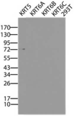 KRT5 Monoclonal Antibody (OTI1E6), TrueMAB , OriGene:Antibodies:Primary