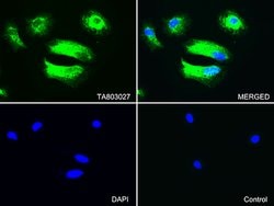 KRT7 Monoclonal Antibody (OTI1B6), TrueMAB , OriGene 100 &mu;L; Unconjugated:Antibodies,