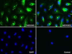 KRT7 Mouse anti-Human, Clone: OTI3B7, lyophilized, TrueMAB 100 &mu;g; Unconjugated:Antibodies,