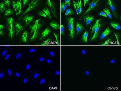 KRT7 Monoclonal Antibody (OTI2G4), TrueMAB , OriGene 30 &mu;L; Unconjugated:Antibodies,