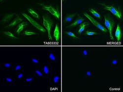 KRT7 Monoclonal Antibody (OTI2D1), TrueMAB , OriGene:Antibodies:Primary