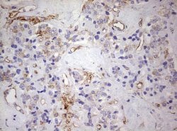 KRT7 Monoclonal Antibody (OTI1B3), TrueMAB , OriGene 100 &mu;L; Unconjugated:Antibodies,