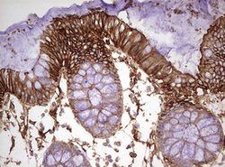 KRT7 Monoclonal Antibody (OTI1B3), TrueMAB , OriGene 100 &mu;L; Unconjugated:Antibodies,