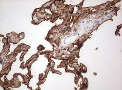 KRT7 Monoclonal Antibody (OTI1B3), TrueMAB , OriGene 100 &mu;L; Unconjugated:Antibodies,
