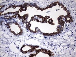 KRT7 Monoclonal Antibody (OTI1B6), TrueMAB , OriGene 100 &mu;L; Unconjugated:Antibodies,