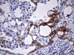 KRT7 Monoclonal Antibody (OTI1B6), TrueMAB , OriGene 100 &mu;L; Unconjugated:Antibodies,
