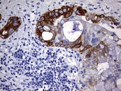 KRT7 Monoclonal Antibody (OTI1B6), TrueMAB , OriGene 100 &mu;L; Unconjugated:Antibodies,