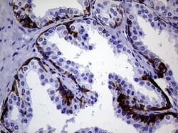 KRT7 Monoclonal Antibody (OTI1B6), TrueMAB , OriGene 100 &mu;L; Unconjugated:Antibodies,