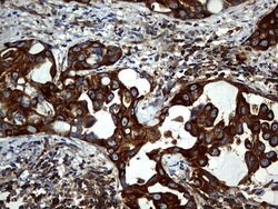 KRT7 Mouse anti-Human, Clone: OTI3B7, lyophilized, TrueMAB 100 &mu;g; Unconjugated:Antibodies,