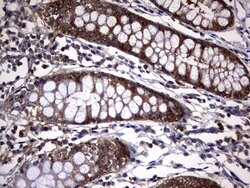 KRT7 Mouse anti-Human, Clone: OTI3B7, lyophilized, TrueMAB 100 &mu;g; Unconjugated:Antibodies,