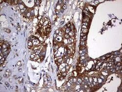 KRT7 Mouse anti-Human, Clone: OTI3B7, lyophilized, TrueMAB 100 &mu;g; Unconjugated:Antibodies,