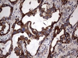 KRT7 Monoclonal Antibody (OTI2A2), TrueMAB , OriGene 100 &mu;L; Unconjugated:Antibodies,