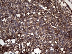 KRT7 Monoclonal Antibody (OTI2A2), TrueMAB , OriGene 100 &mu;L; Unconjugated:Antibodies,