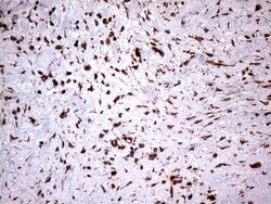 KRT7 Monoclonal Antibody (OTI2A2), TrueMAB , OriGene 100 &mu;L; Unconjugated:Antibodies,