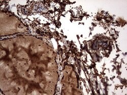 KRT7 Monoclonal Antibody (OTI2A2), TrueMAB , OriGene 100 &mu;L; Unconjugated:Antibodies,