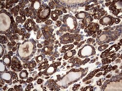 KRT7 Monoclonal Antibody (OTI2A2), TrueMAB , OriGene 100 &mu;L; Unconjugated:Antibodies,