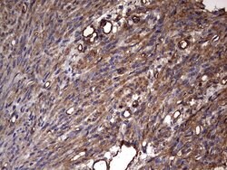 KRT7 Monoclonal Antibody (OTI2A2), TrueMAB , OriGene 100 &mu;L; Unconjugated:Antibodies,