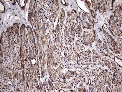 KRT7 Monoclonal Antibody (OTI2A2), TrueMAB , OriGene 100 &mu;L; Unconjugated:Antibodies,