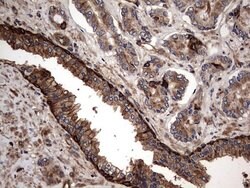 KRT7 Monoclonal Antibody (OTI2A2), TrueMAB , OriGene 100 &mu;L; Unconjugated:Antibodies,