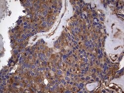 KRT7 Monoclonal Antibody (OTI2A2), TrueMAB , OriGene 100 &mu;L; Unconjugated:Antibodies,