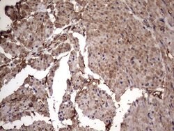 KRT7 Monoclonal Antibody (OTI2A2), TrueMAB , OriGene 100 &mu;L; Unconjugated:Antibodies,