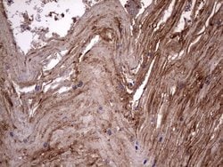 KRT7 Monoclonal Antibody (OTI2A2), TrueMAB , OriGene 100 &mu;L; Unconjugated:Antibodies,