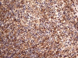 KRT7 Monoclonal Antibody (OTI2A2), TrueMAB , OriGene 100 &mu;L; Unconjugated:Antibodies,
