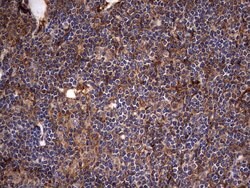 KRT7 Monoclonal Antibody (OTI2A2), TrueMAB , OriGene 100 &mu;L; Unconjugated:Antibodies,