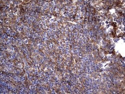 KRT7 Monoclonal Antibody (OTI2A2), TrueMAB , OriGene 100 &mu;L; Unconjugated:Antibodies,