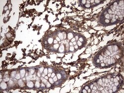 KRT7 Monoclonal Antibody (OTI2A2), TrueMAB , OriGene 100 &mu;L; Unconjugated:Antibodies,