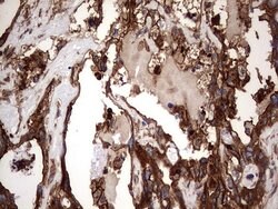 KRT7 Monoclonal Antibody (OTI2A2), TrueMAB , OriGene 100 &mu;L; Unconjugated:Antibodies,