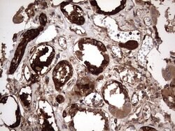 KRT7 Monoclonal Antibody (OTI2A2), TrueMAB , OriGene 100 &mu;L; Unconjugated:Antibodies,