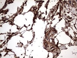 KRT7 Monoclonal Antibody (OTI2A2), TrueMAB , OriGene 100 &mu;L; Unconjugated:Antibodies,