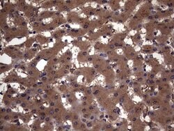 KRT7 Monoclonal Antibody (OTI2A2), TrueMAB , OriGene 100 &mu;L; Unconjugated:Antibodies,