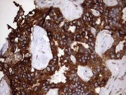KRT7 Monoclonal Antibody (OTI2A2), TrueMAB , OriGene 100 &mu;L; Unconjugated:Antibodies,