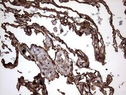 KRT7 Monoclonal Antibody (OTI2A2), TrueMAB , OriGene 100 &mu;L; Unconjugated:Antibodies,