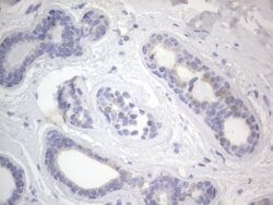 KRT7 Monoclonal Antibody (OTI2E11), TrueMAB , OriGene 100 &mu;L; Unconjugated:Antibodies,