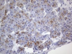 KRT7 Monoclonal Antibody (OTI2E11), TrueMAB , OriGene 100 &mu;L; Unconjugated:Antibodies,