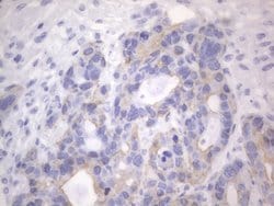 KRT7 Monoclonal Antibody (OTI2E11), TrueMAB , OriGene 100 &mu;L; Unconjugated:Antibodies,