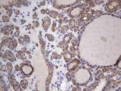 KRT7 Monoclonal Antibody (OTI2E11), TrueMAB , OriGene 100 &mu;L; Unconjugated:Antibodies,