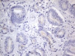 KRT7 Monoclonal Antibody (OTI2E11), TrueMAB , OriGene 100 &mu;L; Unconjugated:Antibodies,