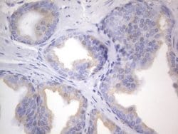 KRT7 Monoclonal Antibody (OTI2E11), TrueMAB , OriGene 100 &mu;L; Unconjugated:Antibodies,
