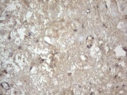 KRT7 Monoclonal Antibody (OTI2E11), TrueMAB , OriGene 100 &mu;L; Unconjugated:Antibodies,