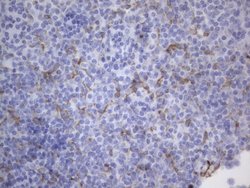 KRT7 Monoclonal Antibody (OTI2E11), TrueMAB , OriGene:Antibodies:Primary