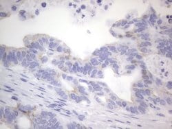 KRT7 Monoclonal Antibody (OTI2E11), TrueMAB , OriGene 100 &mu;L; Unconjugated:Antibodies,