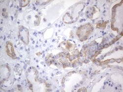 KRT7 Monoclonal Antibody (OTI2E11), TrueMAB , OriGene 100 &mu;L; Unconjugated:Antibodies,