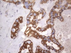 KRT7 Monoclonal Antibody (OTI2E11), TrueMAB , OriGene 100 &mu;L; Unconjugated:Antibodies,