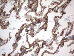 KRT7 Monoclonal Antibody (OTI2E11), TrueMAB , OriGene 100 &mu;L; Unconjugated:Antibodies,