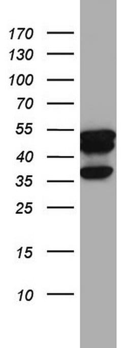 KRT7 Monoclonal Antibody (OTI1B3), TrueMAB , OriGene 100 &mu;L; Unconjugated:Antibodies,